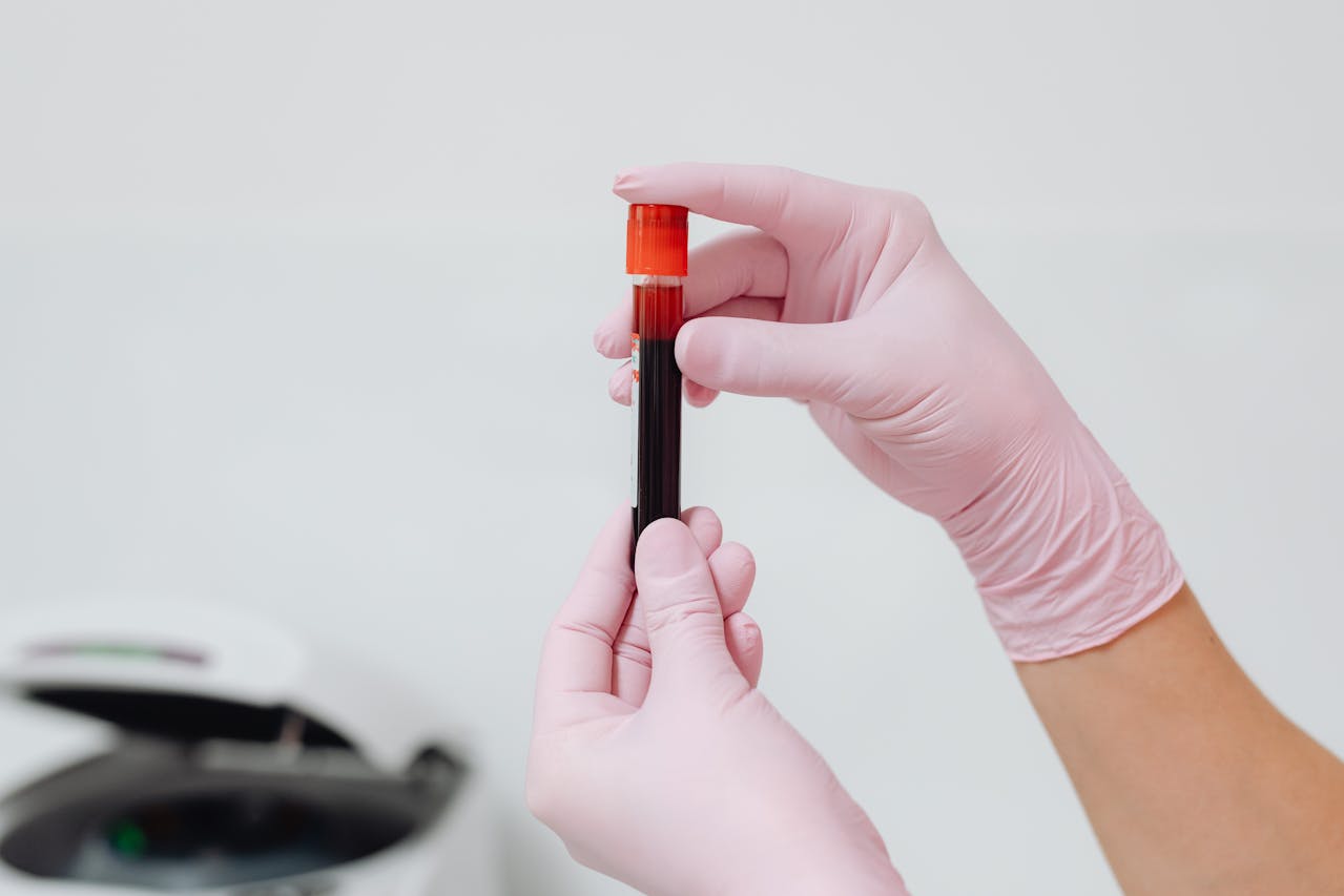 How Often Should You Get Blood Work Done